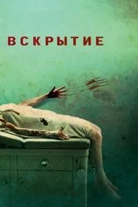 Розтин